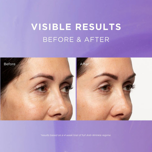 Fadeout Anti-Wrinkle Brightening Day Cream SPF25 – 50ml