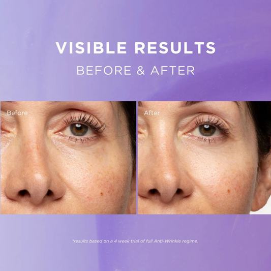 Fadeout Anti-Wrinkle Brightening Night Cream – 50ml