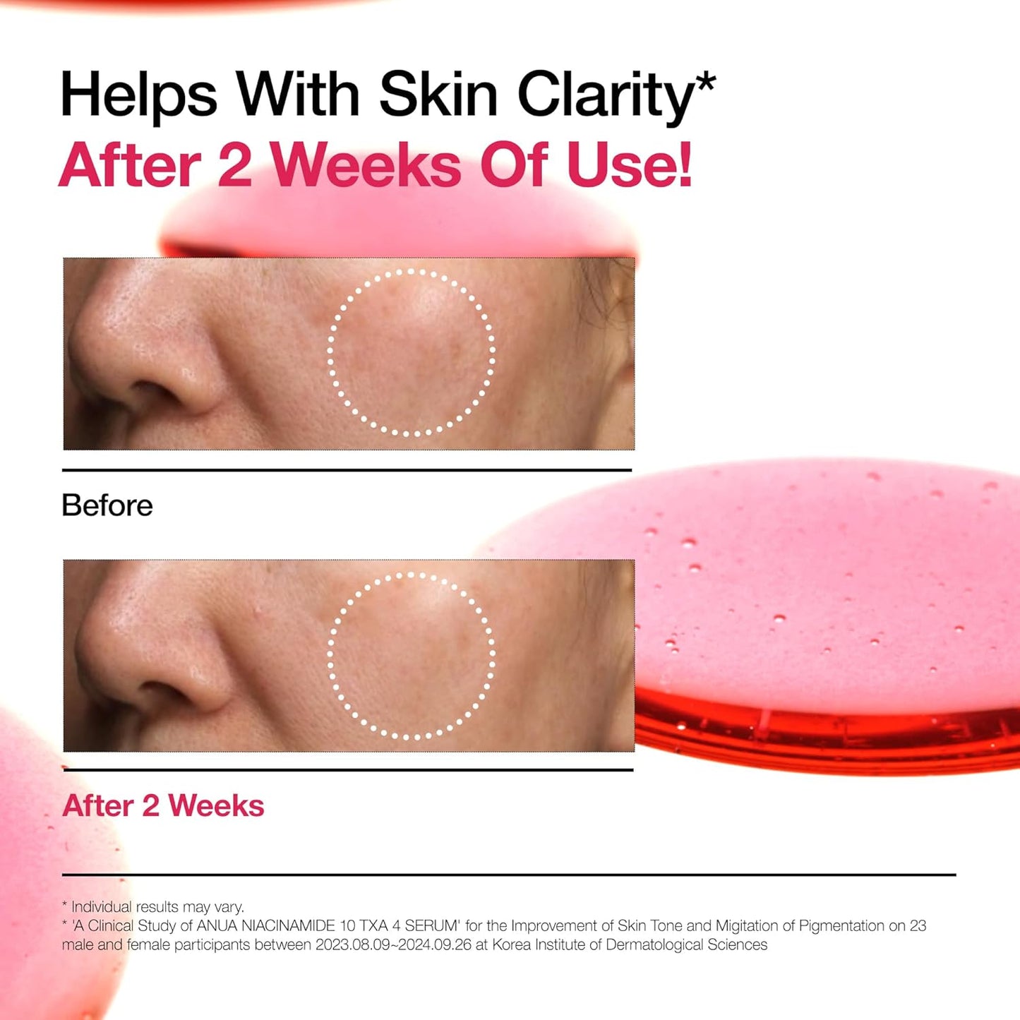 Anua 10% Niacinamide + 4% Tranexamic Acid Serum 30ml