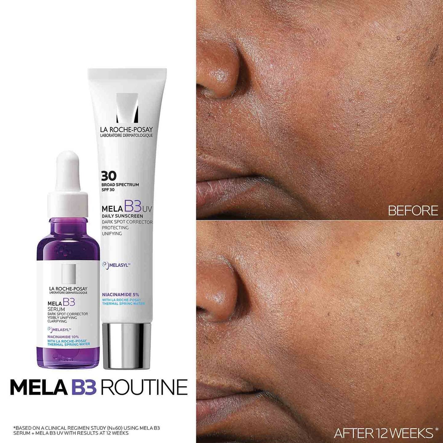 La Roche-Posay Mela B3 Dark Spot Serum – 30ml