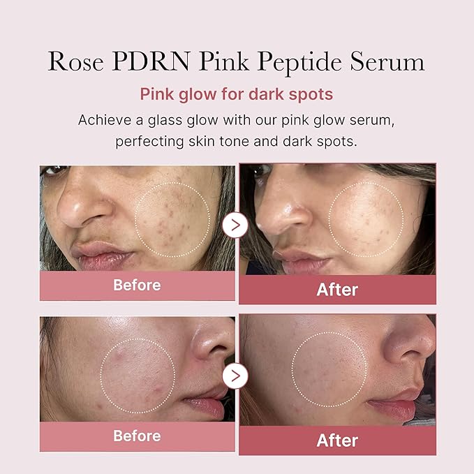 Medicube PDRN Pink Peptide Serum – 30ml