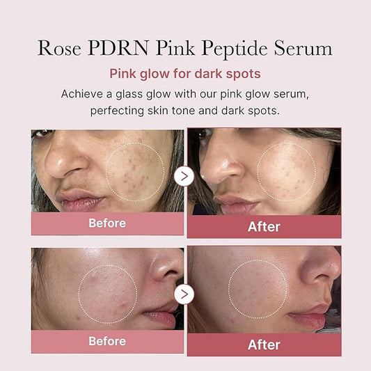 Medicube PDRN Pink Peptide Serum – 30ml