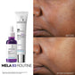 La Roche-Posay Mela B3 Dark Spot Serum – 30ml